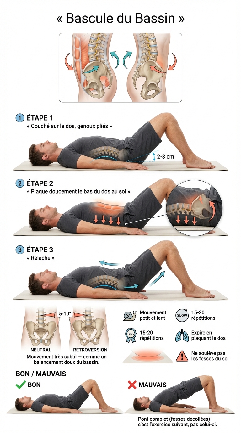 איור הטיית אגן