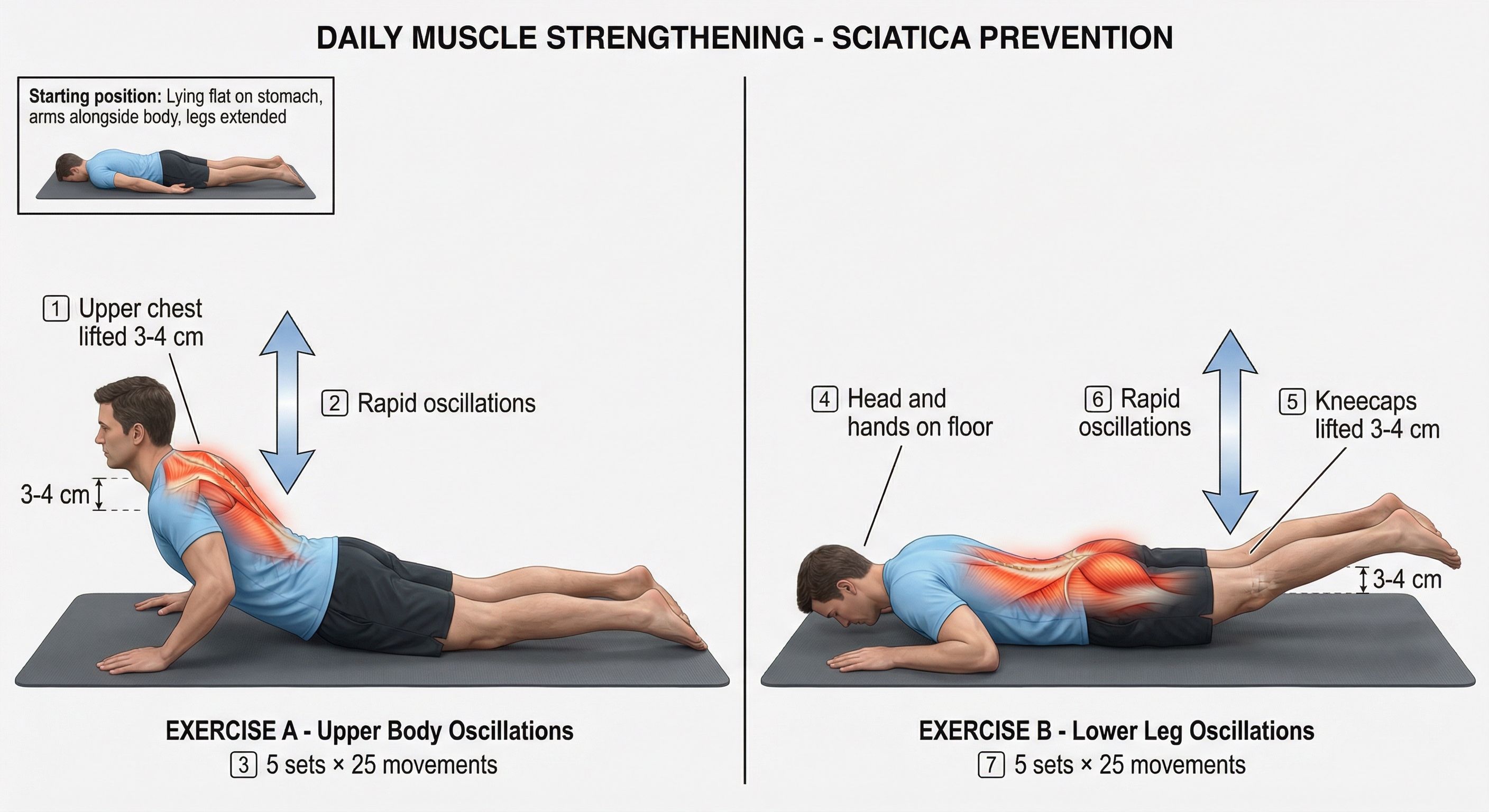 Muscle strengthening for sciatica prevention
